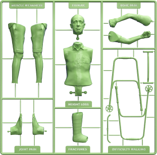 Tumor Induced Osteomalacia Symptoms